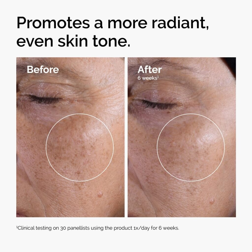 Before and After Effect of The Ordinary Glycolic Acid 7% Exfoliating Toner