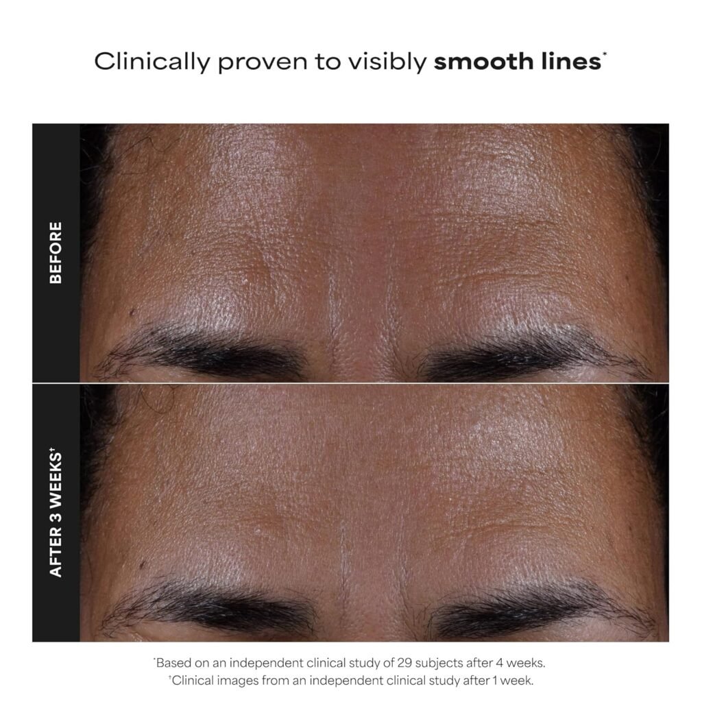 Before and After Use of Paula’s Choice 2% BHA Liquid Exfoliant