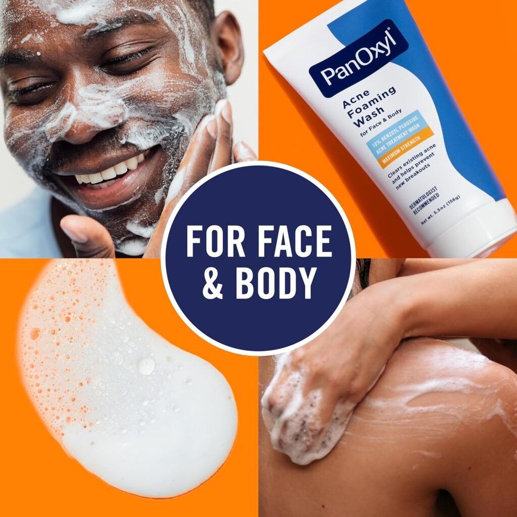 Face and Body Acne Solution