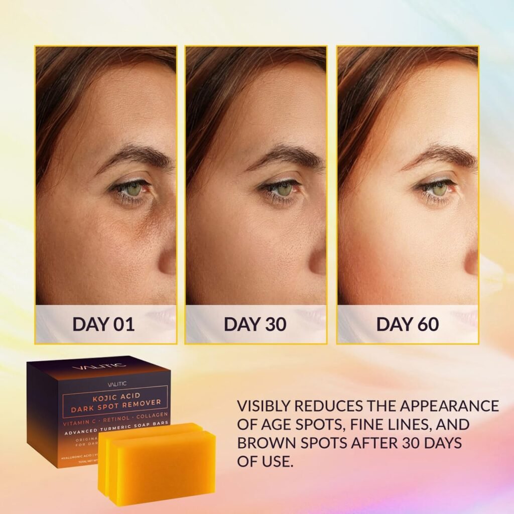 Dark Spot Remover Soap Benefits