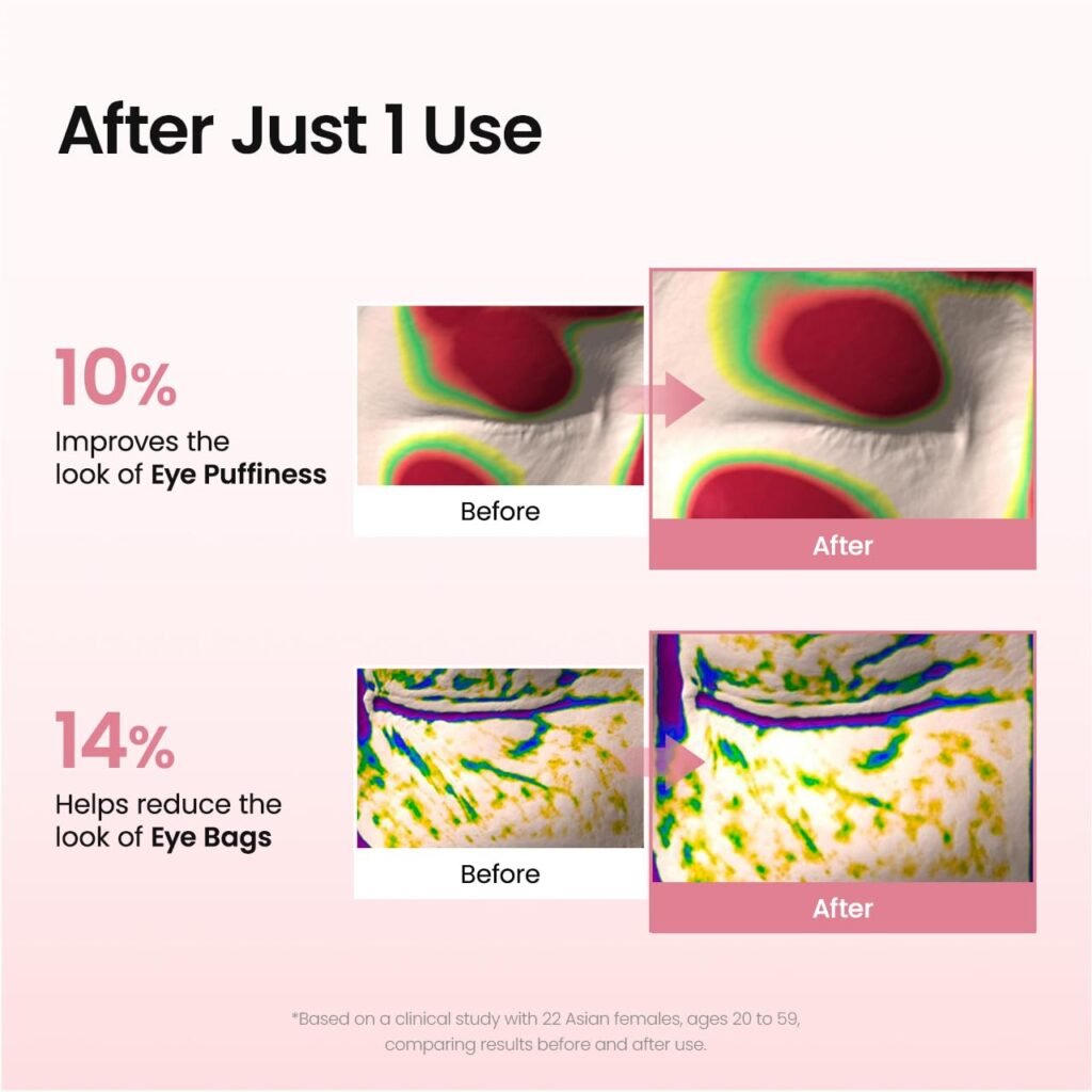 Helps Reduce Puffiness